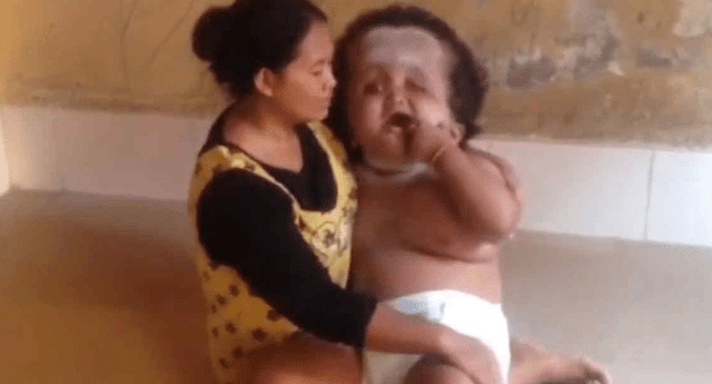 Bebé gigante asombra al mundo, pero el cuidado de su madre es aplaudido. 