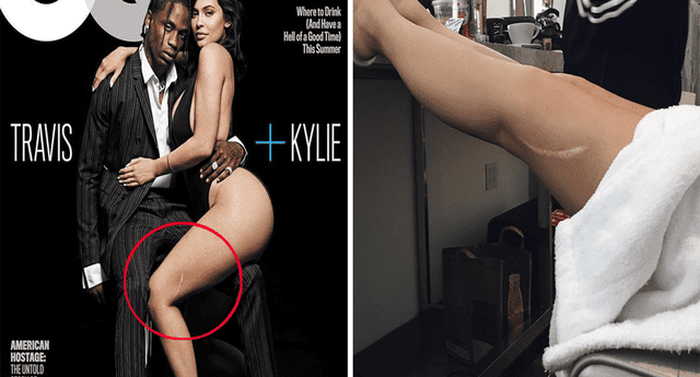  Kylie Jenner presumió su cicatriz y asustó a todos. 