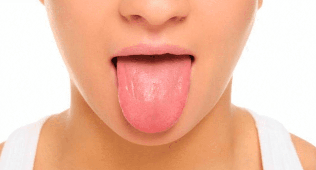 Especialistas explicaron que la "lengua negra peluda" puede ser efecto del consumo de antibióticos, alcohol, tabaco o mala higiene