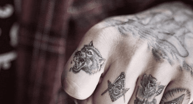 Hombre intenta sacarse tatuaje con procedimiento láser y obtiene terrorífico resultado