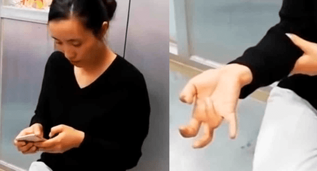 Mujer china pasó sus vacaciones manipulando su celular sin imaginar las terribles consecuencias que sufrirían sus dedos