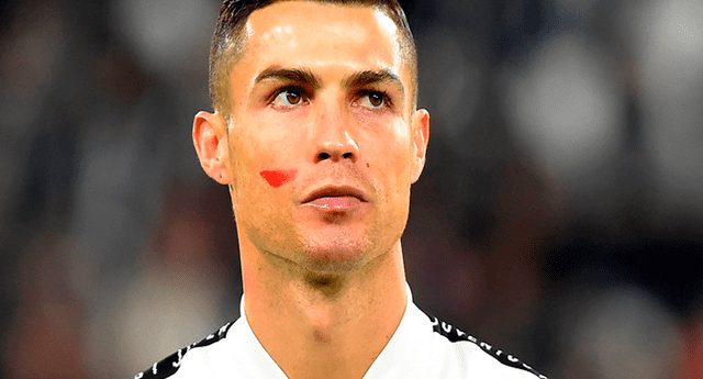 Ronaldo y todos los jugadores del fútbol italiano salieron a las canchas con una misteriosa mancha roja en la mejilla debida a una iniciativa de la ONU