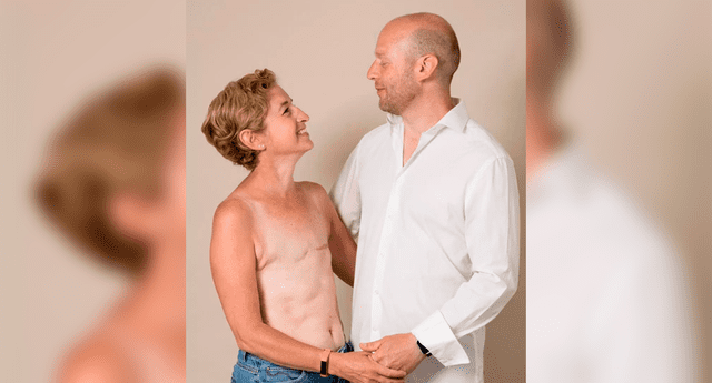 Gemma Cockrell se desnudó para mostrar la realidad tras sobrevivir al cáncer.