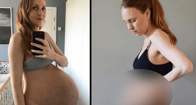 ¿Recuerdas a la mujer embarazada de trillizos? Así quedó su cuerpo tras el parto