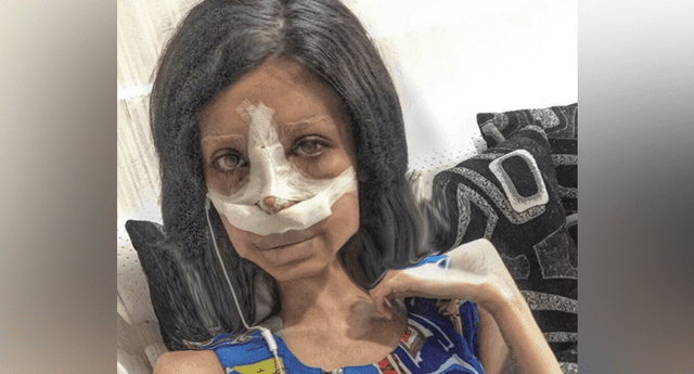 Las escalofriantes fotos de Sahar Tabar, la Angelina Jolie “zombie” tras nueva cirugía en su rostro.