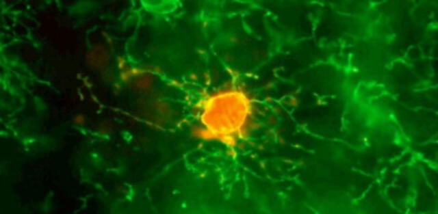 ¡Increíble! Científicos crean neuronas que son capaces de incorporarse en el tejido cerebral humano