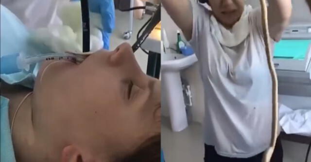 ¡Ni en tus peores pesadillas! Médicos extraen serpiente de más de un metro de la garganta de una mujer (VIDEO)