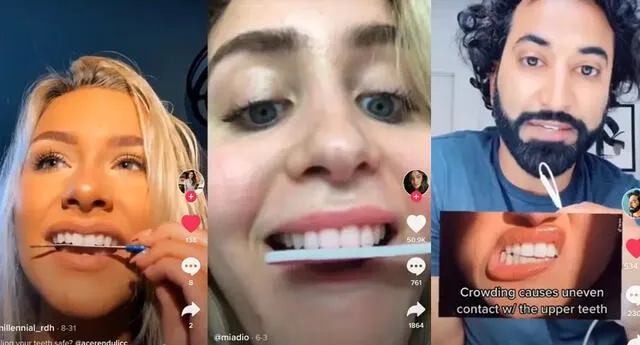 Nueva moda peligrosa en TikTok: Jóvenes se liman los dientes para que queden parejos