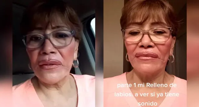 Mujer asustar a su hija con una "mala cirugía" pero broma sale mal (Foto: Captura TikTok)