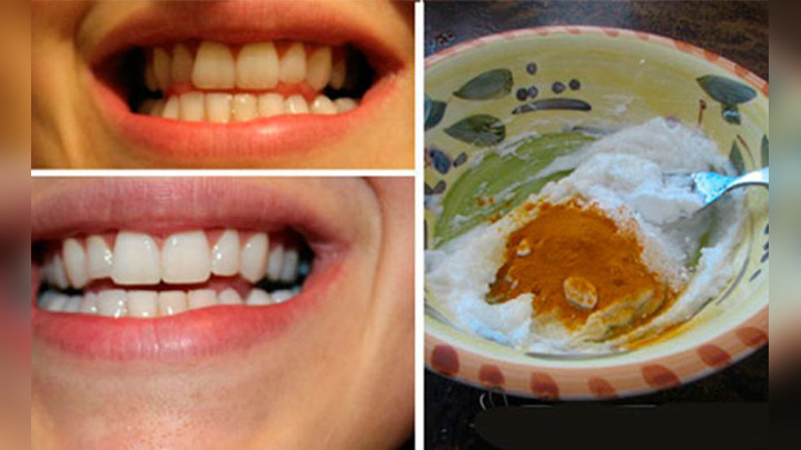 La pasta dental casera que blanquea dientes, previene caries y enfermedades  en las encías | Aweita La República